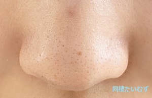 洗顔前の鼻