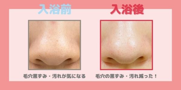 お風呂でホットタオルを使って洗顔してみた 鼻の角栓はどうなった 写真で比較 検証 あたし美化計画 お風呂でホットタオルを使って洗顔してみた 鼻の角栓はどうなった 写真で比較 検証 あたし美化計画
