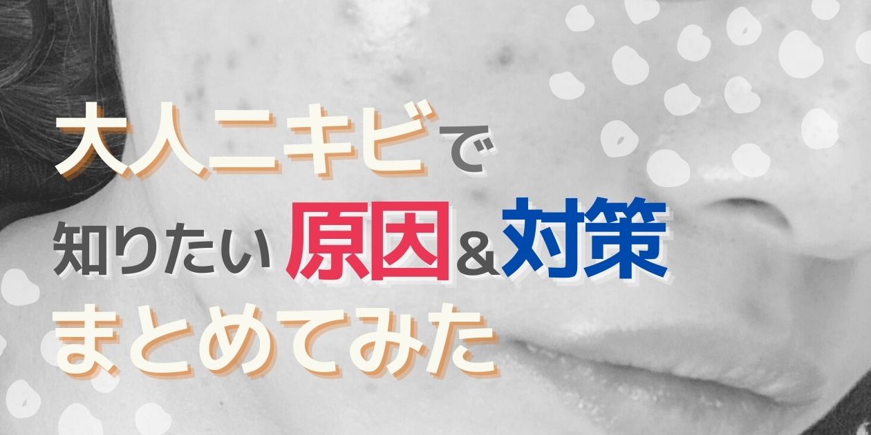 「これが大人ニキビの原因かも？」男女別の原因・予防策【徹底解説】